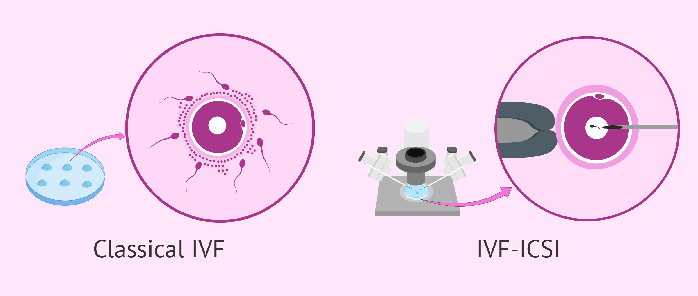 IVF vs ICSI success