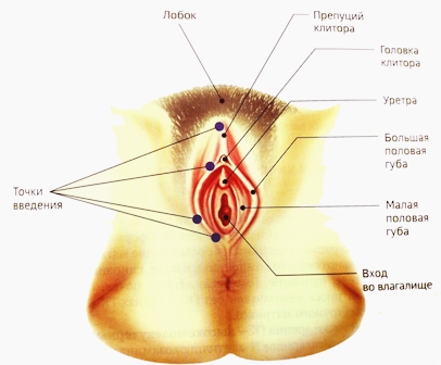 Точки введения плазмы наружные половые органы